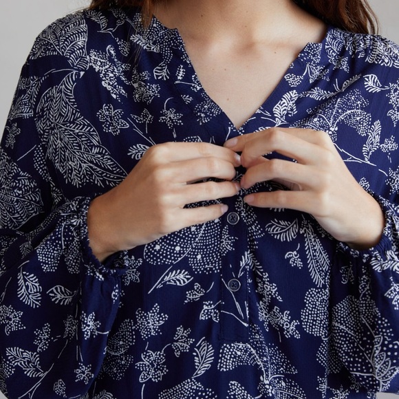 Anthropologie | ELYN TUNIC DRESS | Size XS - Picture 3 of 7